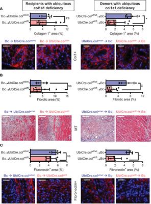 Donor-But Not Recipient-Derived Cells Produce Collagen-1 in Chronically Rejected Cardiac Allografts